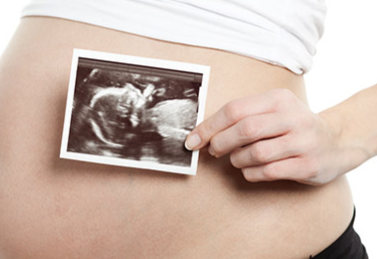 Pregnant woman holding an ultrasound image of foetus at a fertility clinic