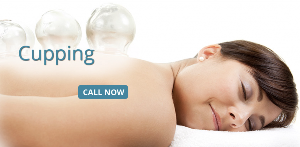 Cupping treatment